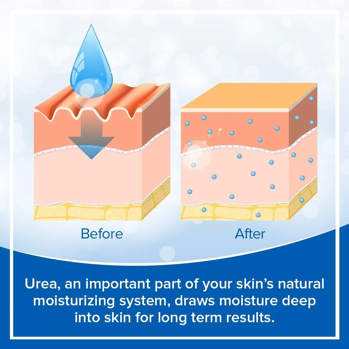 Dry Spot Roll On Treatment - 10% Urea